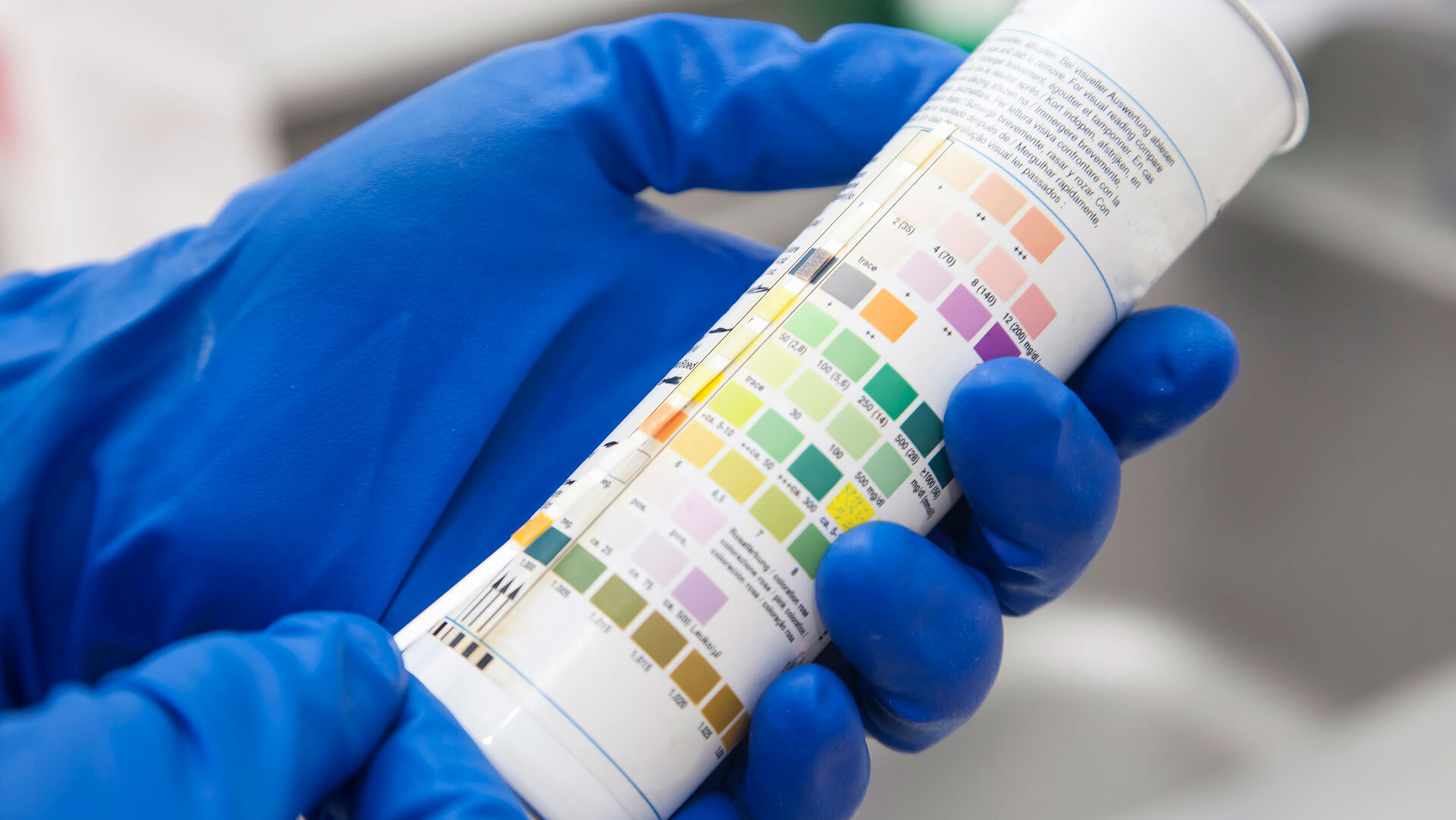 Drug and alcohol testing